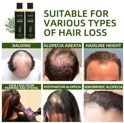 🌱 LAST DAY 50% OFF-Yagoo® Rosemary Hydrolyzed Shampoo , Unlock the Secret to Thicker, Healthier-Looking Hair