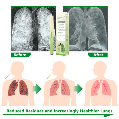 𝐈𝐫𝐞𝐥𝐚𝐧𝐝 𝐎𝐰𝐧𝐞𝐝 𝐚𝐧𝐝 𝐎𝐩𝐞𝐫𝐚𝐭𝐞𝐝✅ 𝐘𝐚𝐠𝐨𝐨® 𝐁𝐨𝐭𝐚𝐧𝐢𝐜𝐚𝐥 𝐌𝐮𝐥𝐥𝐞𝐢𝐧 𝐋𝐮𝐧𝐠 𝐂𝐥𝐞𝐚𝐧𝐬𝐞 𝐃𝐢𝐟𝐟𝐮𝐬𝐞𝐫(Cough, Pharyngitis, shortness of breath, sputum, stuffy nose, bronchitis, bronchitis, allergy symptoms, lung discomfort)🔥