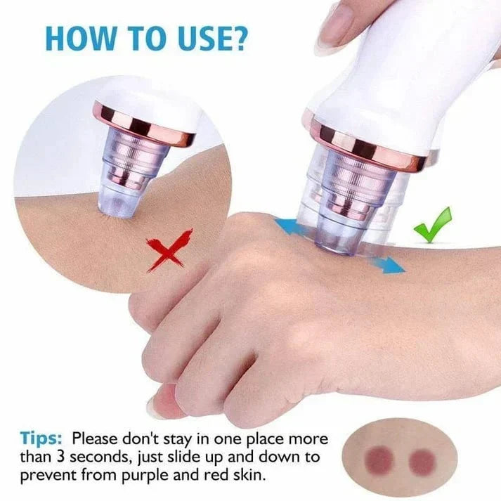✨ Powerful Blackhead Removal Machine – Skin Care & Pore Cleaner 💧